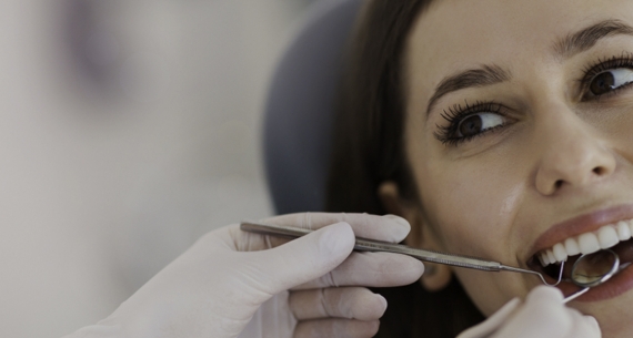 Porcelain vs Composite veneers