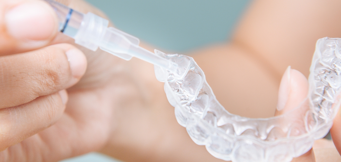 Benefits of Teeth Whitening