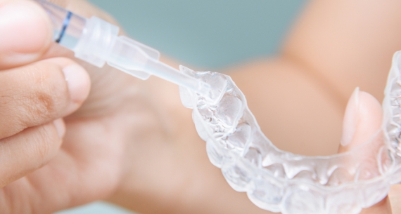 Benefits of Teeth Whitening