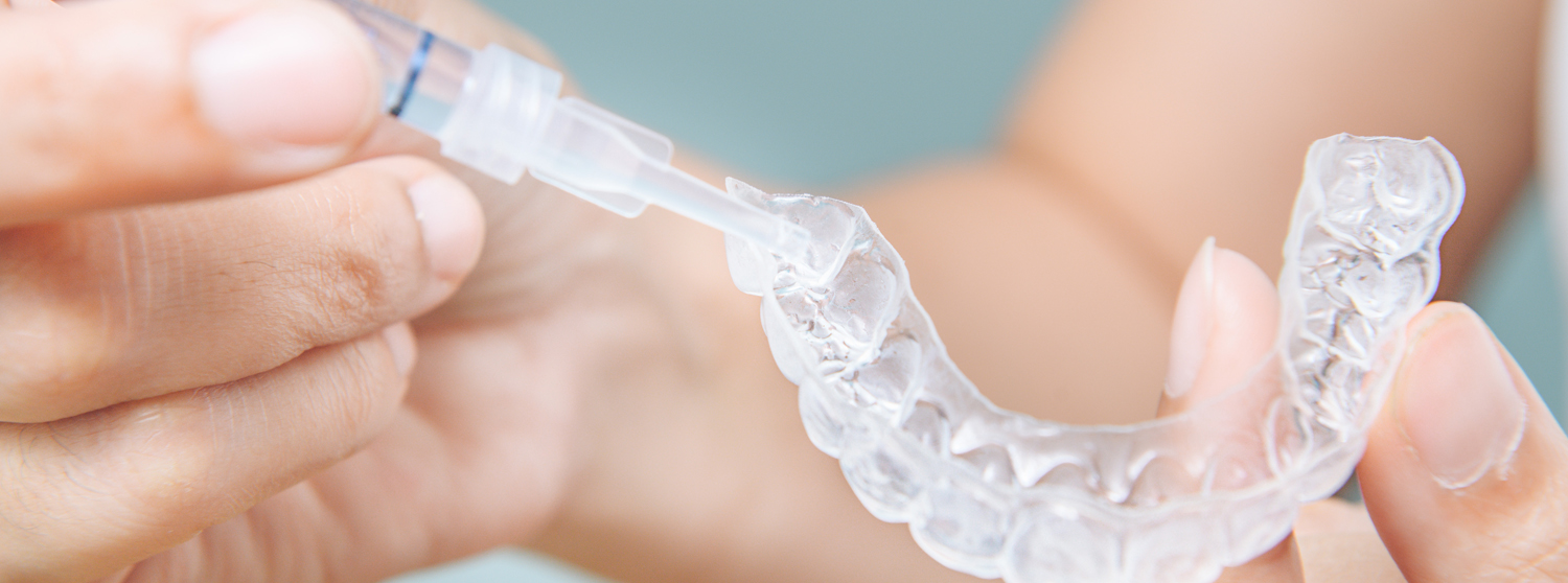 Benefits of Teeth Whitening